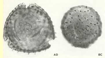 Жимолость обыкновенная (Lonicera xylosteum L.)-пыльцевые зерна Жимолость обыкновенная (Lonicera xylosteum L.)-пыльцевые зерна